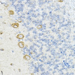 Leucine-Rich Repeat-Containing Protein 59 (LRRC59) Antibody