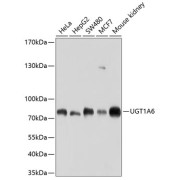 Western blot analysis of various lysates using UGT1A6 Antibody at 1/1000 dilution. Secondary antibody: HRP-conjugated Goat anti-Rabbit IgG (H+L) at 1/10000 dilution. Lysates/proteins: 25 µg per lane. Blocking buffer: 3% nonfat dry milk in TBST. Exposure time: 60s.