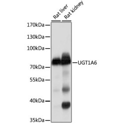 UDP-Glucuronosyltransferase 1-6 (UGT1A6) Antibody
