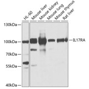 Western blot analysis of various lysates using IL17RA Antibody at 1/1000 dilution. Secondary antibody: HRP-conjugated Goat anti-Rabbit IgG (H+L) at 1/10000 dilution. Lysates/proteins: 25 µg per lane. Blocking buffer: 3% nonfat dry milk in TBST. Exposure time: 5s.