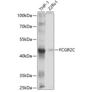 Western blot analysis of various lysates using FCGR2C Antibody at 1/1000 dilution. Secondary antibody: HRP-conjugated Goat anti-Rabbit IgG (H+L) at 1/10000 dilution. Lysates/proteins: 25 µg per lane. Blocking buffer: 3% nonfat dry milk in TBST. Exposure time: 10s.