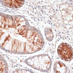 Killer Cell Immunoglobulin Like Receptor 3DL3 (KIR3DL3) Antibody
