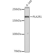 Western blot analysis of lysates from A-549 cells, using PLA2R1 Antibody at 1/1000 dilution. Secondary antibody: HRP-conjugated Goat anti-Rabbit IgG (H+L) at 1/10000 dilution. Lysates/proteins: 25 µg per lane. Blocking buffer: 3% nonfat dry milk in TBST. Exposure time: 3s.