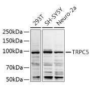 Western blot analysis of various lysates using TRPC5 Antibody at 1/1000 dilution. Secondary antibody: HRP-conjugated Goat anti-Rabbit IgG (H+L) at 1/10000 dilution. Lysates/proteins: 25 µg per lane. Blocking buffer: 3% nonfat dry milk in TBST. Exposure time: 90s.