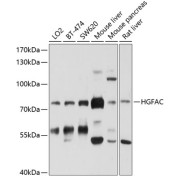 Western blot analysis of various lysates using HGFAC Antibody at 1/1000 dilution. Secondary antibody: HRP-conjugated Goat anti-Rabbit IgG (H+L) at 1/10000 dilution. Lysates/proteins: 25 µg per lane. Blocking buffer: 3% nonfat dry milk in TBST. Exposure time: 30s.