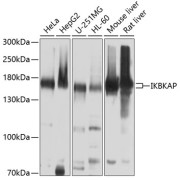 Western blot analysis of various lysates using ELP1 Antibody at 1/1000 dilution. Secondary antibody: HRP-conjugated Goat anti-Rabbit IgG (H+L) at 1/10000 dilution. Lysates/proteins: 25 µg per lane. Blocking buffer: 3% nonfat dry milk in TBST. Exposure time: 10s.