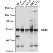 Western blot analysis of various lysates using RBM34 Antibody at 1/1000 dilution. Secondary antibody: HRP-conjugated Goat anti-Rabbit IgG (H+L) at 1/10000 dilution. Lysates/proteins: 25 µg per lane. Blocking buffer: 3% nonfat dry milk in TBST. Exposure time: 5s.