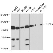 Western blot analysis of various lysates using IL17RB Antibody at 1/1000 dilution. Secondary antibody: HRP-conjugated Goat anti-Rabbit IgG (H+L) at 1/10000 dilution. Lysates/proteins: 25 µg per lane. Blocking buffer: 3% nonfat dry milk in TBST. Exposure time: 5s.