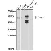 Western blot analysis of various lysates using CRLF2 Antibody at 1/1000 dilution. Secondary antibody: HRP-conjugated Goat anti-Rabbit IgG (H+L) at 1/10000 dilution. Lysates/proteins: 25 µg per lane. Blocking buffer: 3% nonfat dry milk in TBST. Exposure time: 90s.