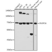 Western blot analysis of various lysates using DUSP16 Antibody at 1/1000 dilution. Secondary antibody: HRP-conjugated Goat anti-Rabbit IgG (H+L) at 1/10000 dilution. Lysates/proteins: 25 µg per lane. Blocking buffer: 3% nonfat dry milk in TBST. Exposure time: 10s.