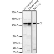 Western blot analysis of various lysates, using C6 Antibody at 1/1000 dilution. Secondary antibody: HRP-conjugated Goat anti-Rabbit IgG (H+L) at 1/10000 dilution. Lysates/proteins: 25 µg per lane. Blocking buffer: 3% nonfat dry milk in TBST. Exposure time: 180s.