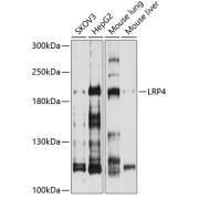 Western blot analysis of various lysates using LRP4 Antibody at 1/1000 dilution. Secondary antibody: HRP-conjugated Goat anti-Rabbit IgG (H+L) at 1/10000 dilution. Lysates/proteins: 25 µg per lane. Blocking buffer: 3% nonfat dry milk in TBST.