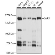 Western blot analysis of various lysates using IARS Antibody at 1/1000 dilution. Secondary antibody: HRP-conjugated Goat anti-Rabbit IgG (H+L) at 1/10000 dilution. Lysates/proteins: 25 µg per lane. Blocking buffer: 3% nonfat dry milk in TBST. Exposure time: 1s.