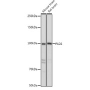 Western blot analysis of various lysates using PLD2 Antibody at 1/500 dilution. Secondary antibody: HRP-conjugated Goat anti-Rabbit IgG (H+L) at 1/10000 dilution. Lysates/proteins: 25 µg per lane. Blocking buffer: 3% nonfat dry milk in TBST. Exposure time: 1s.
