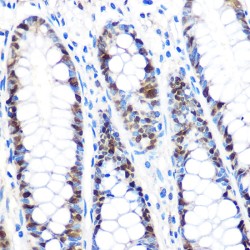 Proliferating Cell Nuclear Antigen (PCNA) Antibody