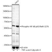 Western blot analysis of lysates from HeLa cells, using Phospho-NF-kB p65/RelA-S276 Antibody at 1/400 dilution. HeLa cells were treated by TNF-α (20 ng/ml) and Calyculin A (100 nM) at 37 °C for 30 minutes after serum-starvation overnight. Secondary antibody: HRP-conjugated Goat anti-Rabbit IgG (H+L) at 1/10000 dilution. Lysates/proteins: 25 µg per lane. Blocking buffer: 3% nonfat dry milk in TBST. Exposure time: 180s.