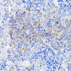 SET And MYND Domain-Containing Protein 4 (SMYD4) Antibody