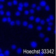 Immunofluorescence analysis of PC12 cells. Methanol fixed cells were permeabilized in 0.1% Triton X-100 in TBS for 5-10 mins, blocked with 3% BSA-PBS for 30 min, room temperature prior to analysis. Cells were incubated with primary antibody (3% BSA-PBS, overnight, 4 °C, humidified). Cells were washed with PBST at room temperature in the dark. Hoechst 33342 was used to stain cell nuclei (blue).