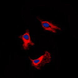 Adenosine Receptor A2b (ADORA2B) Antibody