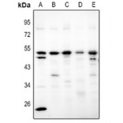 Western blot analysis of Adenosine A2b Receptor expression in (A) HCT116, (B) A375, (C) EC9706, (D) CT26, and (E) C6 whole cell lysates.