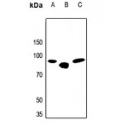 Western blot analysis of Beta-glucuronidase expression in (A) HeLa, (B) Mouse Liver, and (C) Rat Lung whole cell lysates, using Beta-Glucuronidase (GUSB) Antibody.