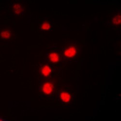 NFkB p65 (pT435) Antibody