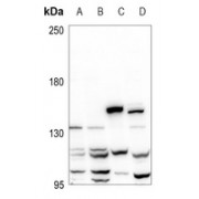 Western blot analysis of Collagen 18 alpha 1 expression in A549 (A), HEK293T (B), AML12 (C) and PC12 (D) whole cell lysates.