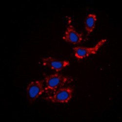 Collagen Type XVIII Alpha 1 (COL18A1) Antibody