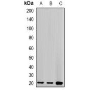 Western blot analysis of Centrin-2 expression in (A) HT29, (B) MCF7, and (C) mouse spleen whole cell lysates.