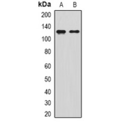 Sirtuin 1 (SIRT1) Antibody