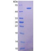 SDS-PAGE analysis of Human 5'-Nucleotidase, Ecto Protein.