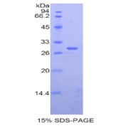 SDS-PAGE analysis of Rat ADAM6 Protein.