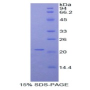 SDS-PAGE analysis of Mouse ADAMTS12 Protein.
