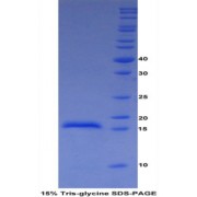 SDS-PAGE analysis of Cow ADAMTS2 Protein.