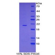 SDS-PAGE analysis of Mouse ADAMTS2 Protein.