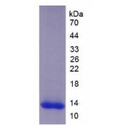 SDS-PAGE analysis of recombinant Human ADAMTS8 Protein.