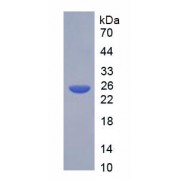 SDS-PAGE analysis of recombinant Rat AChE protein.