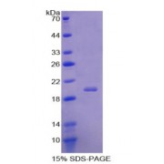 SDS-PAGE analysis of Human Acid Phosphatase 1 Protein.