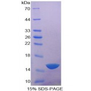 SDS-PAGE analysis of Human Acid Phosphatase 1 Protein.