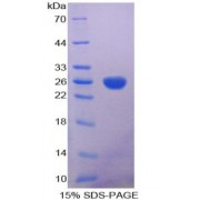 SDS-PAGE analysis of Human Aconitase 1 Protein.