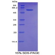 SDS-PAGE analysis of Human ALCAM Protein.