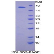 SDS-PAGE analysis of recombinant Mouse ALCAM Protein.