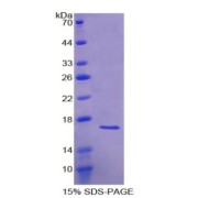 SDS-PAGE analysis of Human ACVR1 Protein.