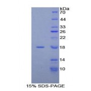 SDS-PAGE analysis of Human ACP Protein.