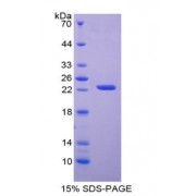 SDS-PAGE analysis of Human APRT Protein.