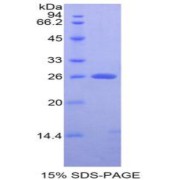 SDS-PAGE analysis of Rat APC Protein.