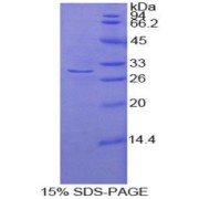 SDS-PAGE analysis of Human ADCY2 Protein.