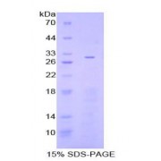 SDS-PAGE analysis of Human Adenylate Cyclase 3 Protein.