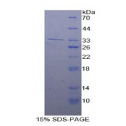 SDS-PAGE analysis of Human Adenylate Cyclase 9 Protein.