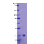 SDS-PAGE analysis of Human CAP1 Protein.